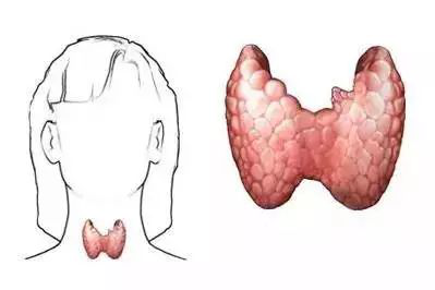 專家解析：有關甲狀腺結節的五大“疑惑”